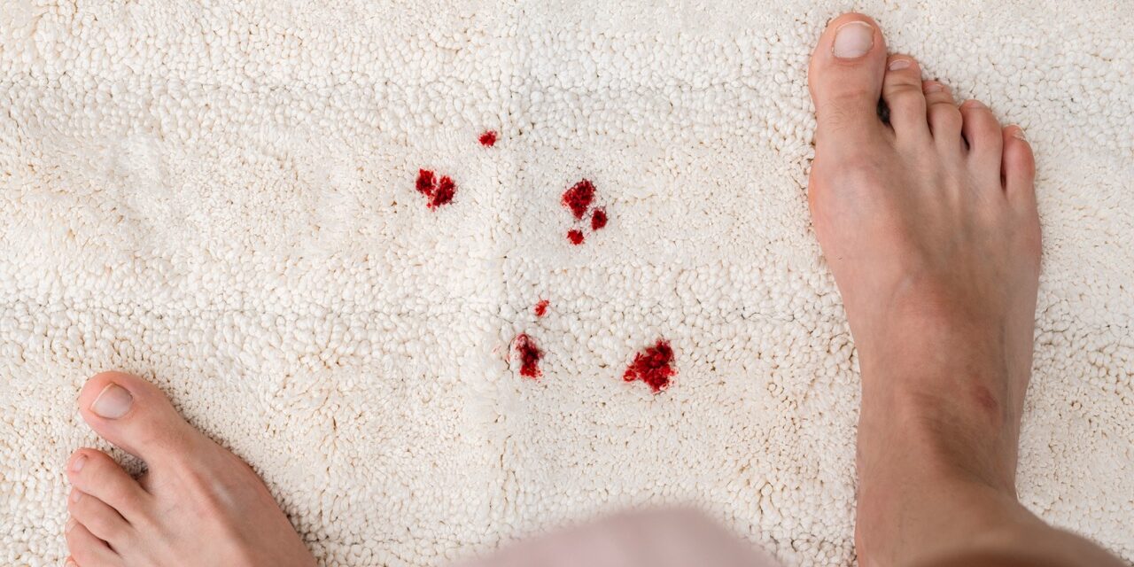 Drops blood stains from menstruation on white fluffy carpet. daily life stain concept. top view.